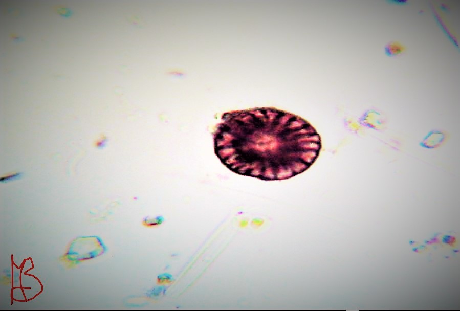 Cyclotella ocellata